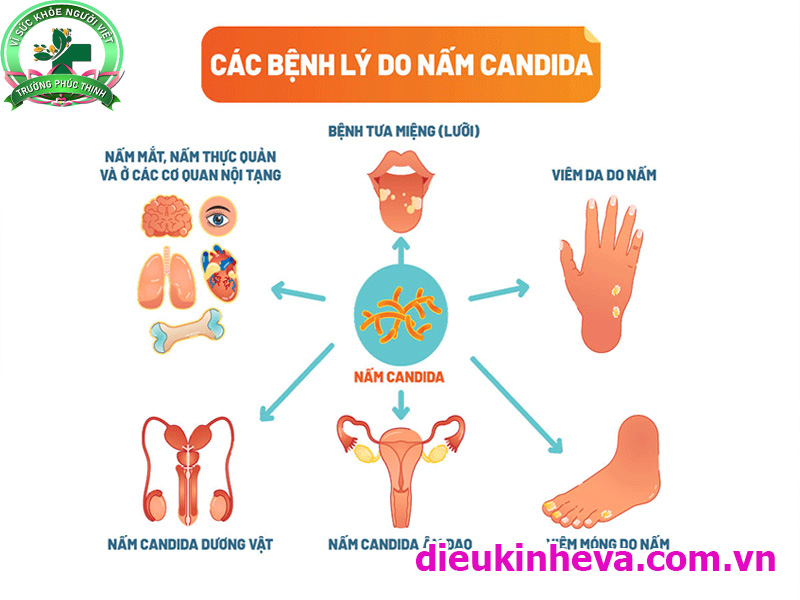 Nấm men Candida sống hoại sinh trên nhiều cơ quan của cơ thể